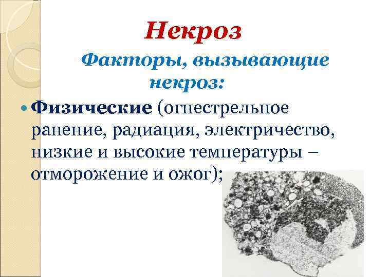 Некроз Факторы, вызывающие некроз: Физические (огнестрельное ранение, радиация, электричество, низкие и высокие температуры –