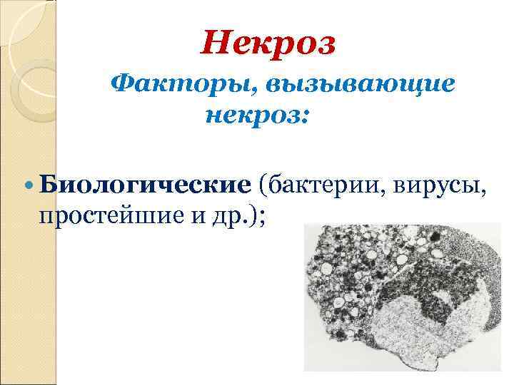 Некроз Факторы, вызывающие некроз: Биологические (бактерии, вирусы, простейшие и др. ); 