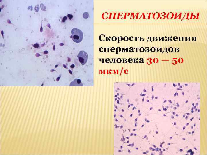 СПЕРМАТОЗОИДЫ Скорость движения сперматозоидов человека 30 — 50 мкм/с 