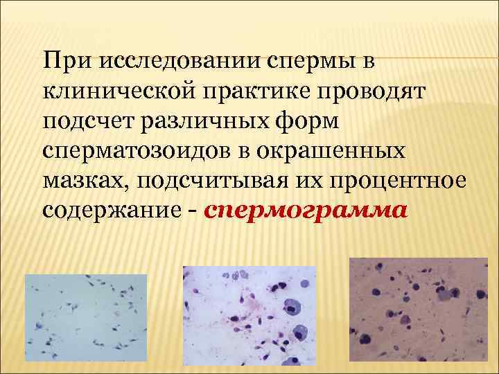 При исследовании спермы в клинической практике проводят подсчет различных форм сперматозоидов в окрашенных мазках,