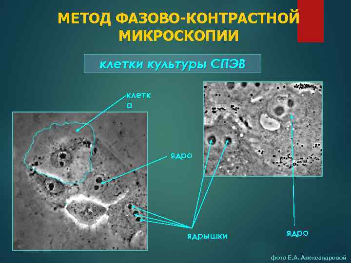 Копрограмма микроскопия кала фото с описанием