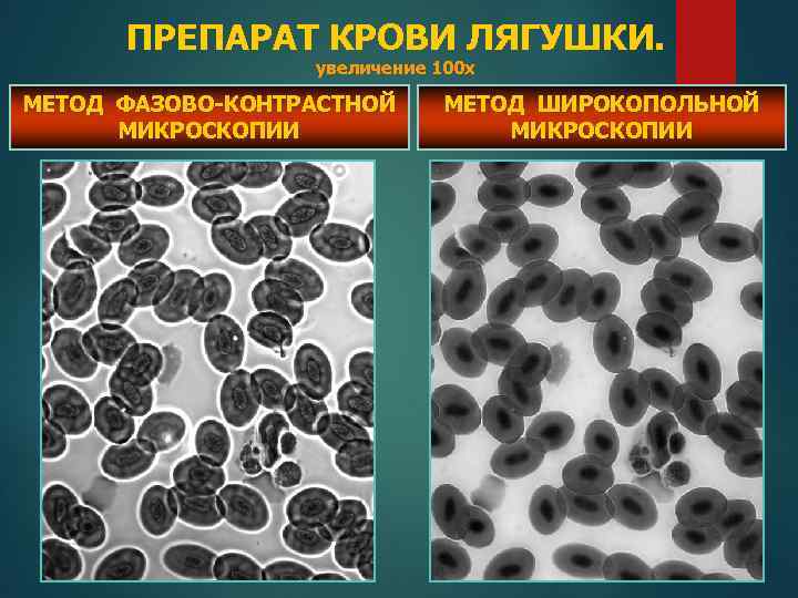 ПРЕПАРАТ КРОВИ ЛЯГУШКИ. увеличение 100 х МЕТОД ФАЗОВО-КОНТРАСТНОЙ МИКРОСКОПИИ МЕТОД ШИРОКОПОЛЬНОЙ МИКРОСКОПИИ 