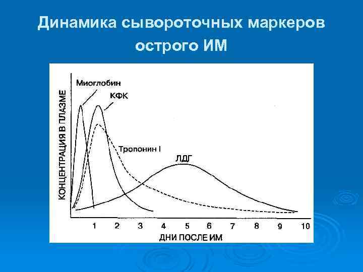 Динамика сывороточных маркеров острого ИМ 