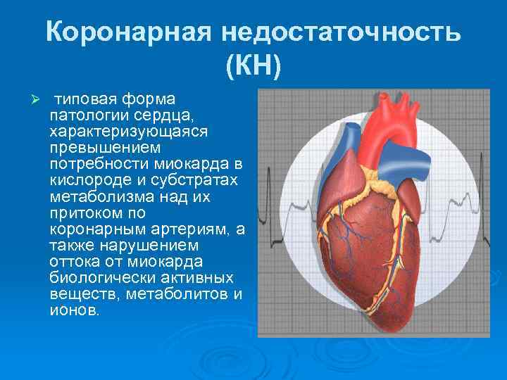 Коронарная недостаточность (КН) Ø типовая форма патологии сердца, характеризующаяся превышением потребности миокарда в кислороде