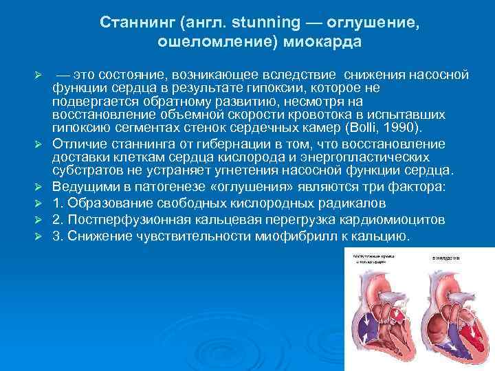 Станнинг (англ. stunning — оглушение, ошеломление) миокарда Ø Ø Ø — это состояние, возникающее