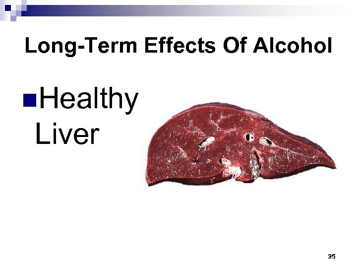 Long-Term Effects Of Alcohol n. Healthy Liver 35 