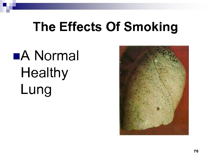 The Effects Of Smoking n. A Normal Healthy Lung 70 