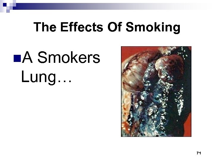 The Effects Of Smoking n. A Smokers Lung… 71 