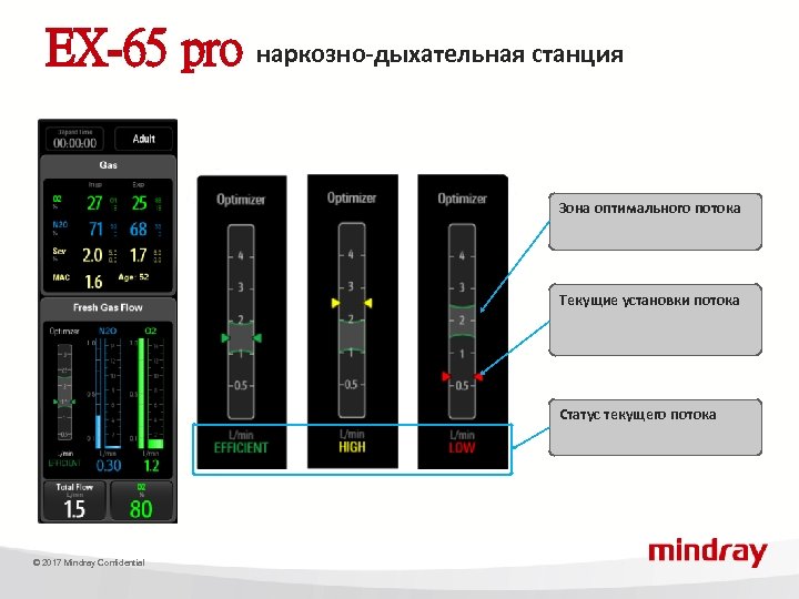 EX-65 pro наркозно-дыхательная станция Зона оптимального потока Текущие установки потока Статус текущего потока ©