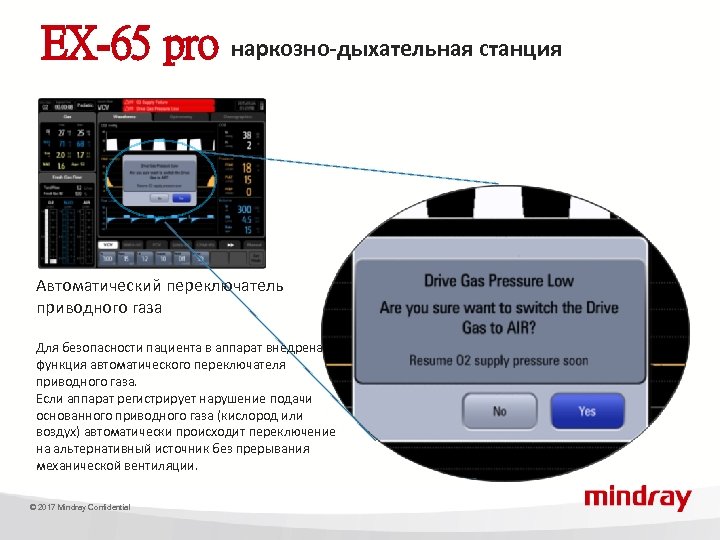 EX-65 pro наркозно-дыхательная станция Автоматический переключатель приводного газа Для безопасности пациента в аппарат внедрена