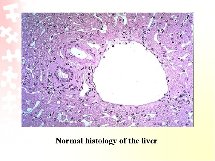 Normal histology of the liver 