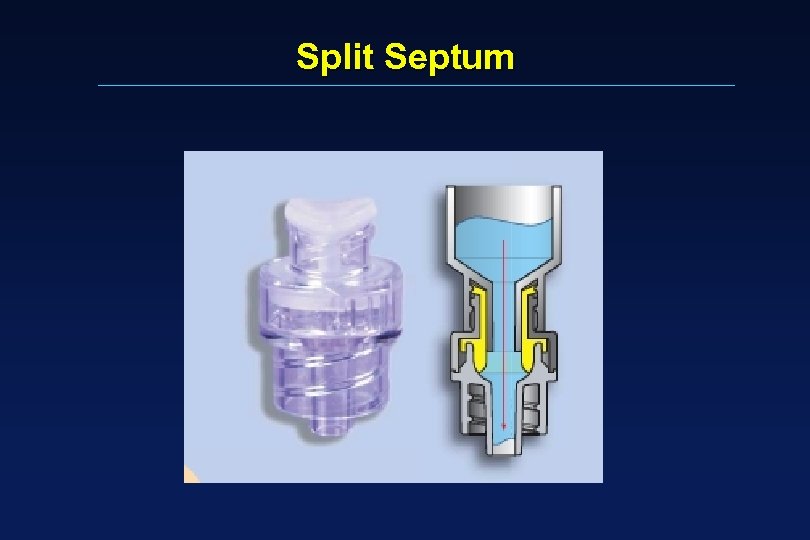 Split Septum 