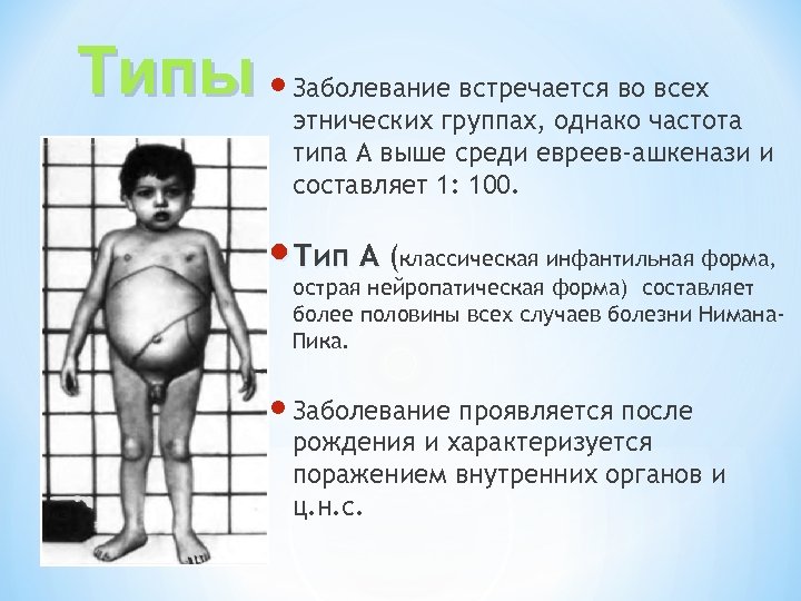 Типы Заболевание встречается во всех этнических группах, однако частота типа А выше среди евреев-ашкенази