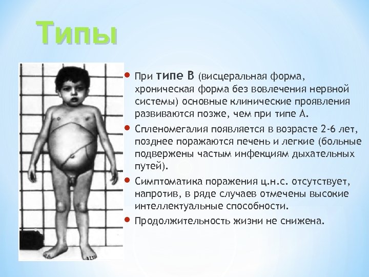 Типы При типе В (висцеральная форма, хроническая форма без вовлечения нервной системы) основные клинические