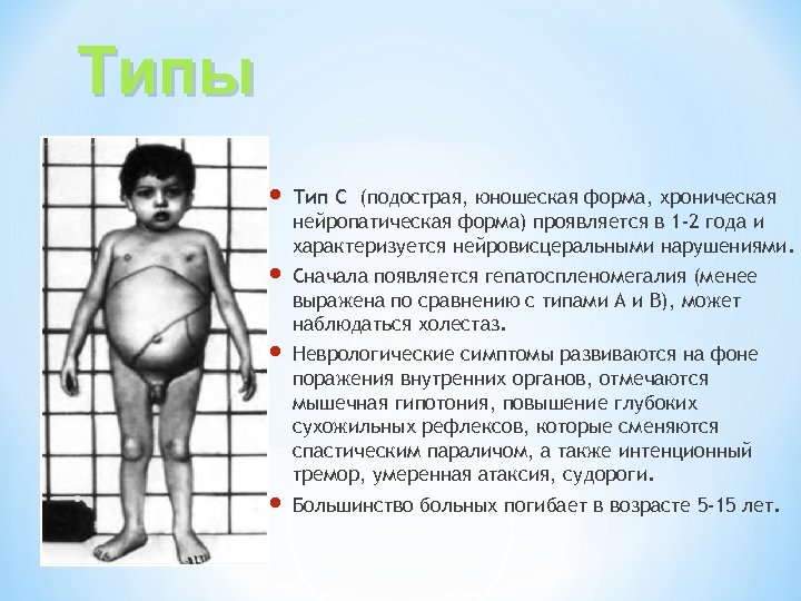 Типы Тип С (подострая, юношеская форма, хроническая нейропатическая форма) проявляется в 1 -2 года