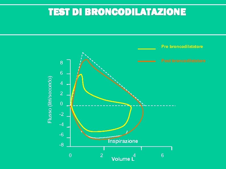 TEST DI BRONCODILATAZIONE Pre broncodilatatore Post broncodilatatore 8 Flusso (litri/secondo) 6 4 2 0