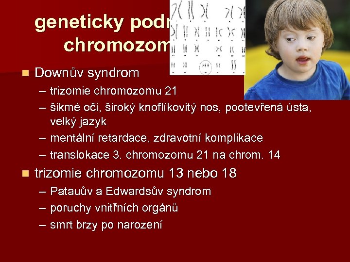 geneticky podmíněné choroby chromozomové aberace n Downův syndrom – trizomie chromozomu 21 – šikmé