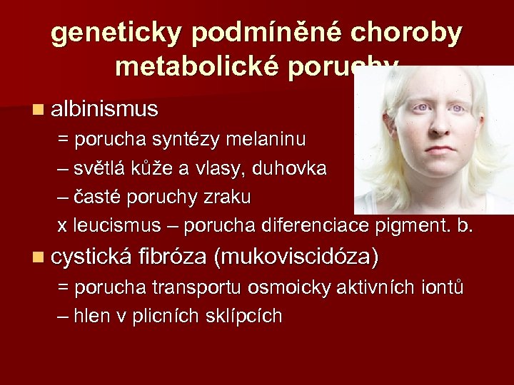 geneticky podmíněné choroby metabolické poruchy n albinismus = porucha syntézy melaninu – světlá kůže