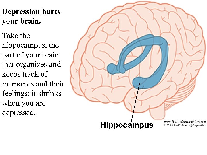 Depression hurts your brain. Take the hippocampus, the part of your brain that organizes