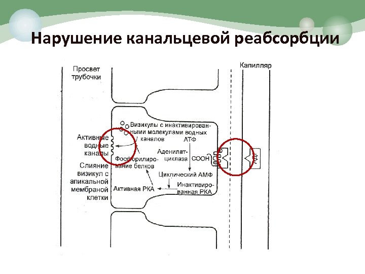 Нарушение канальцевой реабсорбции 