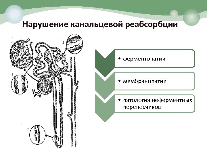 Нарушение канальцевой реабсорбции • ферментопатии • мембранопатии • патология неферментных переносчиков 