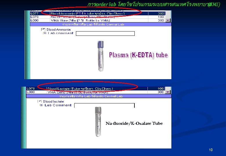 การ order lab โดยใชโปรแกรมระบบสารสนเทศโรงพยาบาล (SMI) Na-fluoride/K-Oxalate Tube 10 