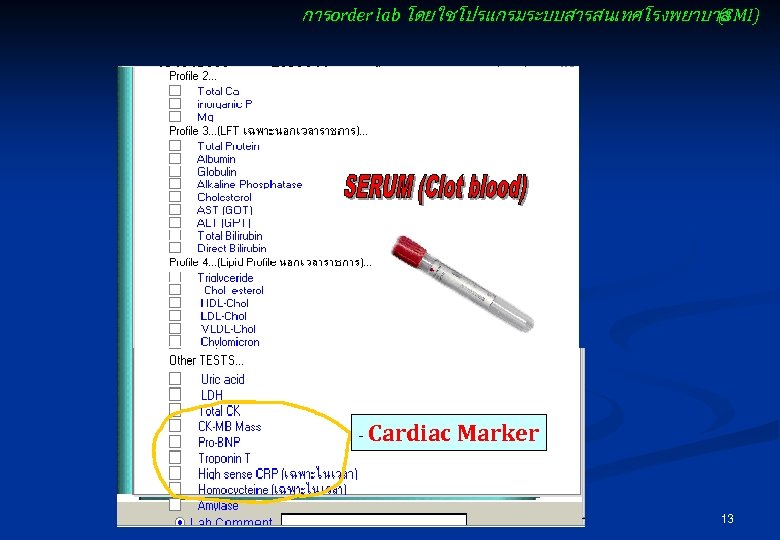 การ order lab โดยใชโปรแกรมระบบสารสนเทศโรงพยาบาล (SMI) - Cardiac Marker 13 