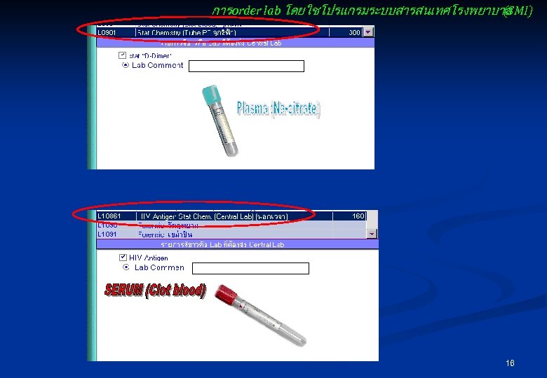 การ order lab โดยใชโปรแกรมระบบสารสนเทศโรงพยาบาล (SMI) 16 