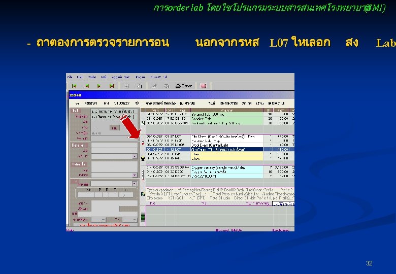 การ order lab โดยใชโปรแกรมระบบสารสนเทศโรงพยาบาล (SMI) - ถาตองการตรวจรายการอน นอกจาก รหส L 07 ใหเลอก สง Lab
