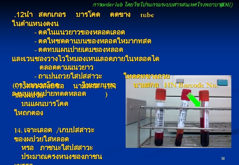 การ order lab โดยใชโปรแกรมระบบสารสนเทศโรงพยาบาล (SMI) . 12นำ สตกเกอร บารโคด ตดขาง tube ในตำแหนงดงน - ตดในแนวยาวของหลอดเลอด