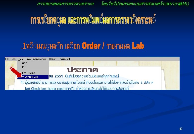 การเรยกดผลการตรวจวเคราะห โดยใชโปรแกรมระบบสารสนเทศโรงพยาบาล (SMI) 42 