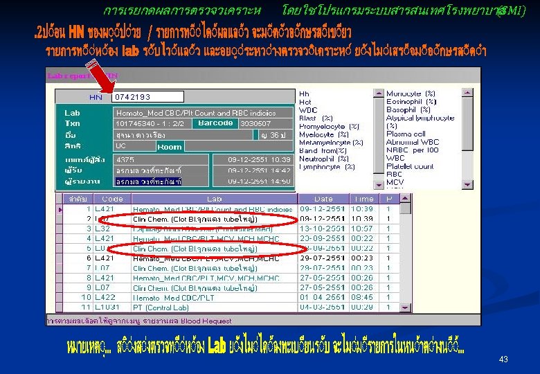 การเรยกดผลการตรวจวเคราะห โดยใชโปรแกรมระบบสารสนเทศโรงพยาบาล (SMI) 43 