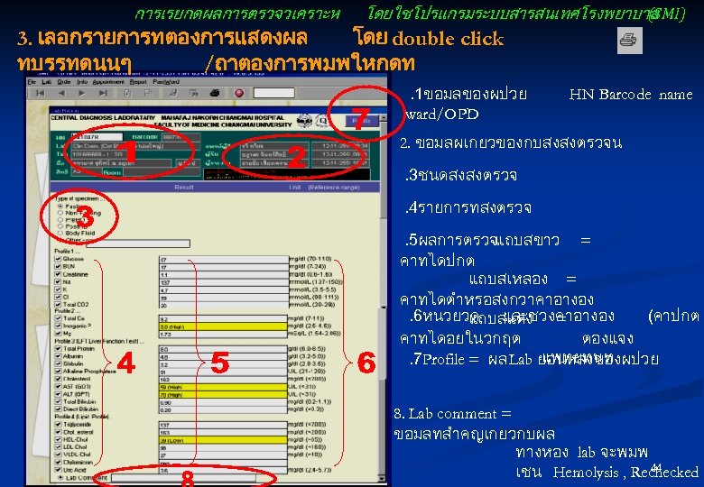 การเรยกดผลการตรวจวเคราะห โดยใชโปรแกรมระบบสารสนเทศโรงพยาบาล (SMI) 3. เลอกรายการทตองการแสดงผล โดย double click ทบรรทดนนๆ /ถาตองการพมพใหกดท . 1ขอมลของผปวย ward/OPD HN