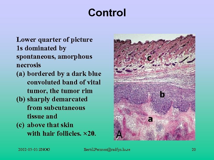 Control Lower quarter of picture 1 s dominated by spontaneous, amorphous necrosis (a) bordered