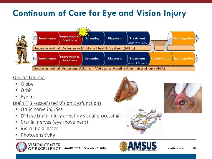 Continuum of Care for Eye and Vision Injury Ocular Trauma • Globe • Orbit