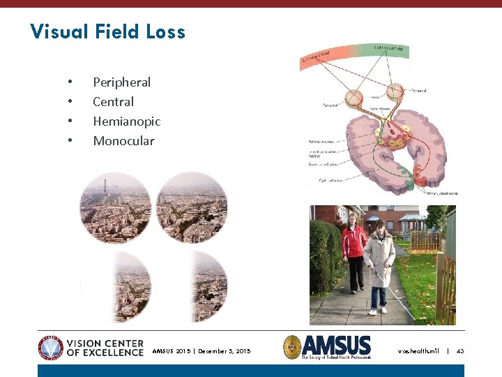 Visual Field Loss • • Peripheral Central Hemianopic Monocular AMSUS 2015 | December 3,