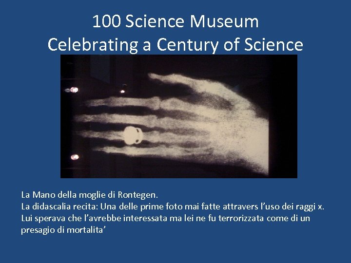 100 Science Museum Celebrating a Century of Science La Mano della moglie di Rontegen.