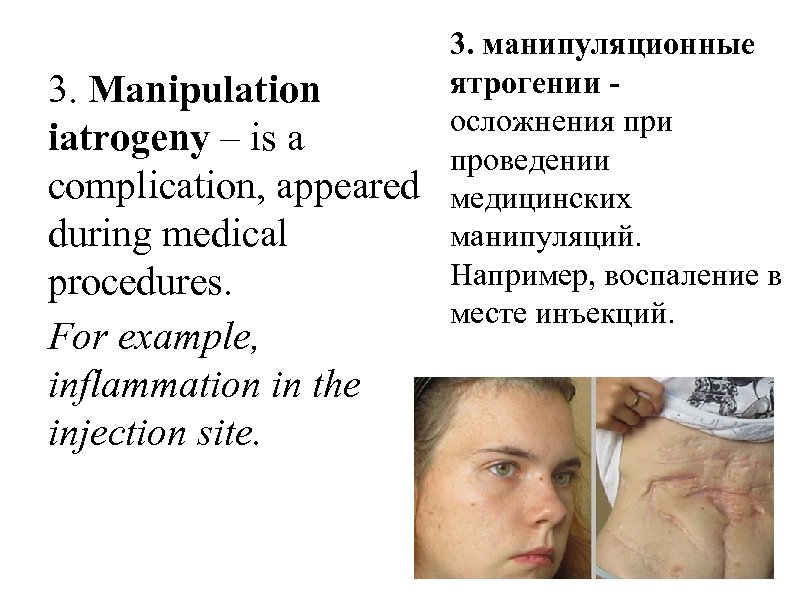 3. Manipulation iatrogeny – is a complication, appeared during medical procedures. For example, inflammation