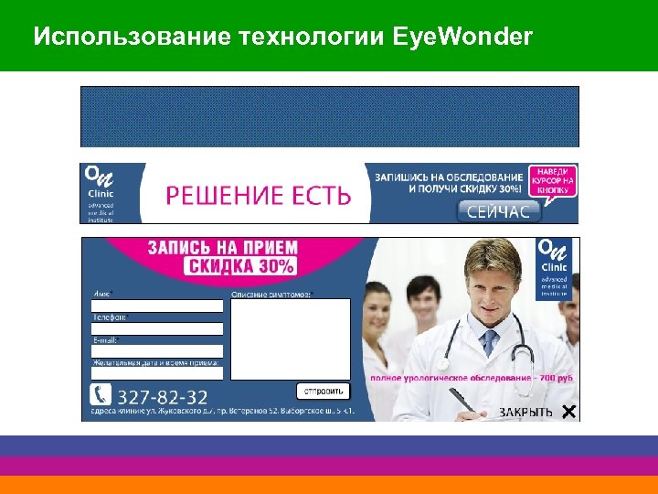 Использование технологии Eye. Wonder 