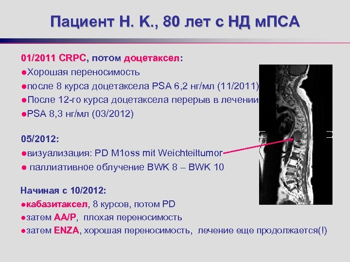 Пациент H. K. , 80 лет с НД м. ПСА 01/2011 CRPC, потом доцетаксел: