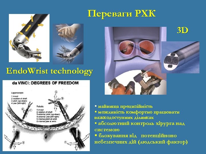 Переваги РХК 3 D Endo. Wrist technology найвища прецизійність можливість комфортно працювати важкодоступних ділянках