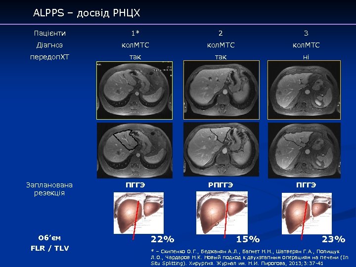 ALPPS – досвід РНЦХ Пацієнти 1* 2 3 Діагноз кол. МТС передоп. ХТ так