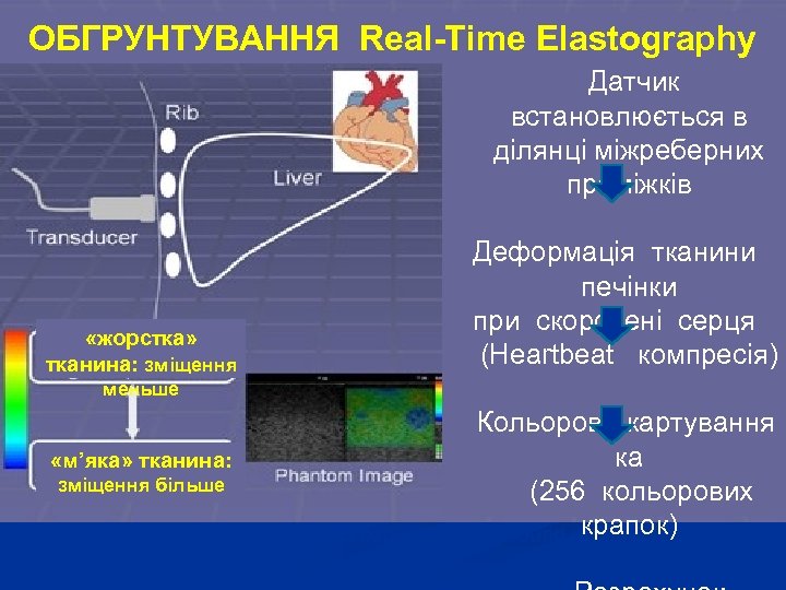 ОБГРУНТУВАННЯ Real-Time Elastography Датчик встановлюється в ділянці міжреберних проміжків «жорстка» тканина: зміщення Деформація тканини