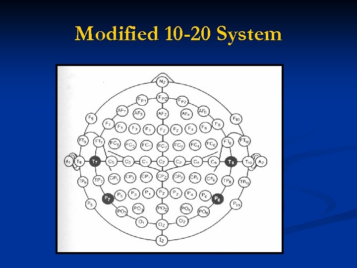 Modified 10 -20 System 