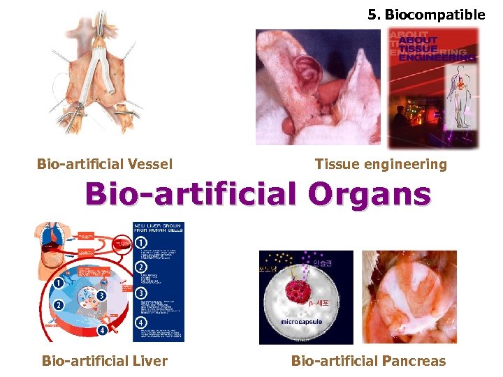 5. Biocompatible Bio-artificial Vessel Tissue engineering Bio-artificial Organs Bio-artificial Liver Bio-artificial Pancreas 