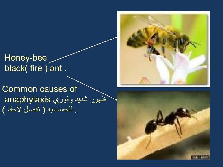 Honey-bee black( fire ) ant. Common causes of anaphylaxis ﻇﻬﻮﺭ ﺷﺪﻳﺪ ﻭﻓﻮﺭﻱ ( .