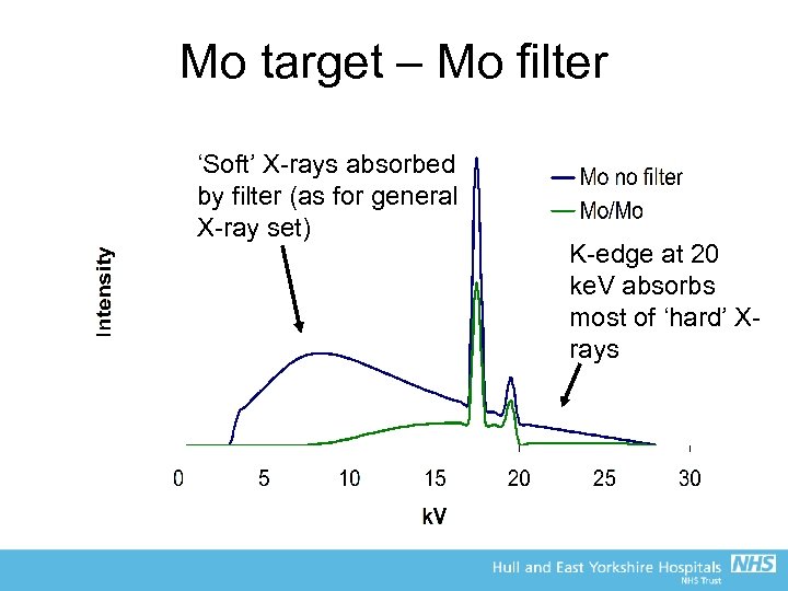 Frcr Physics Lectures Diagnostic Radiology Lecture 8 Mammography