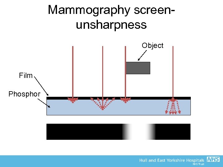 Mammography screenunsharpness Object Film Phosphor 