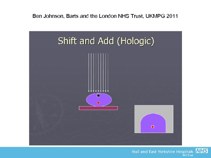 Ben Johnson, Barts and the London NHS Trust, UKMPG 2011 