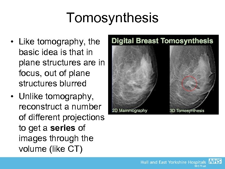 Tomosynthesis • Like tomography, the basic idea is that in plane structures are in